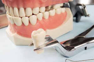 Сколько стоит протезирование зубов в Киеве